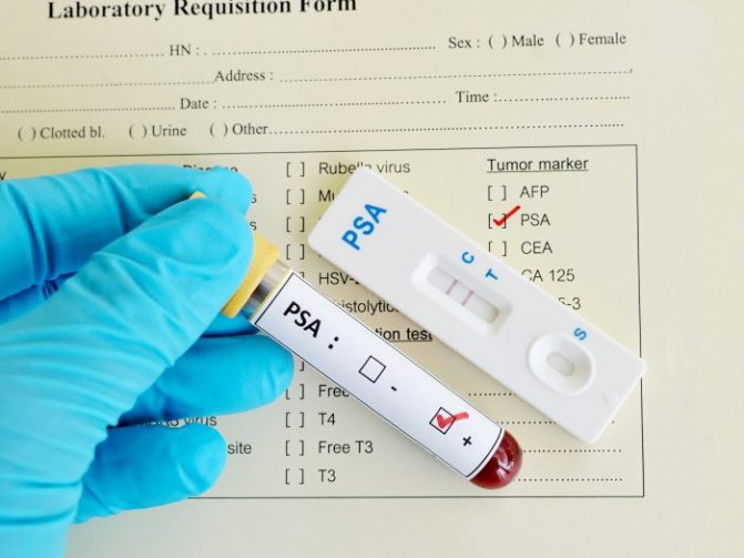 анализ крови на мужские гормоны и на ПСА
