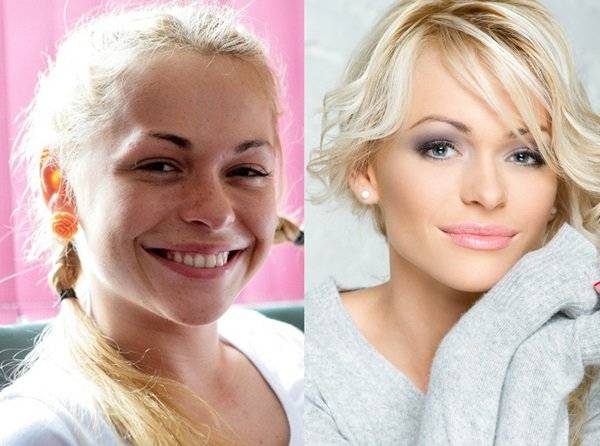 Что случилось с лицом и фигурой Анны Хилькевич: фото до и после пластики
