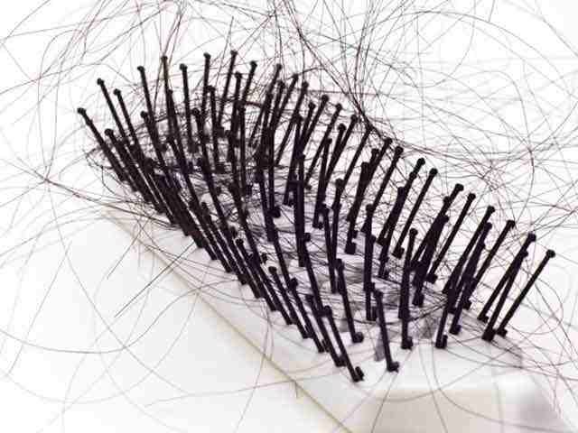 Естественная норма – несколько десятков волосков в день