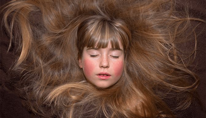 К чему может сниться выпадение волос - толкование по сонникам