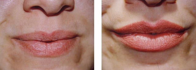 Как сделать губы больше