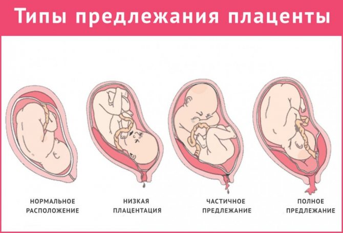 Критические периоды во время беременности. Какие недели наиболее опасны?