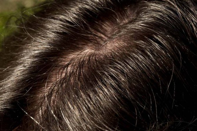 Маску для волос стоит наносить на грязные волосы только в том случае, если она содержит агрессивные компоненты
