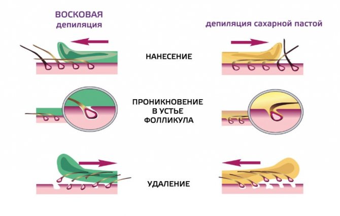 Что такое шугаринг фото интимной зоны для мужчин