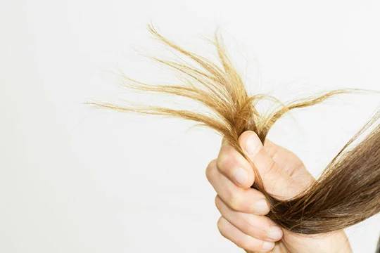 причины истончения волос у женщин