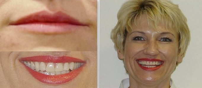 Процедуры для лица и губ