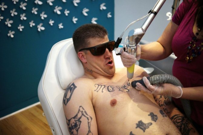 Снятие татуировки в салоне