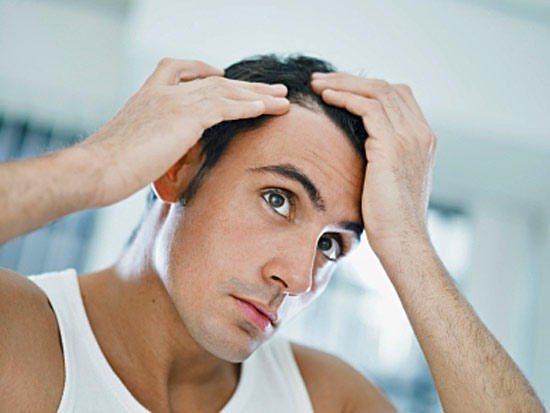 Выпадение волос у мужчин