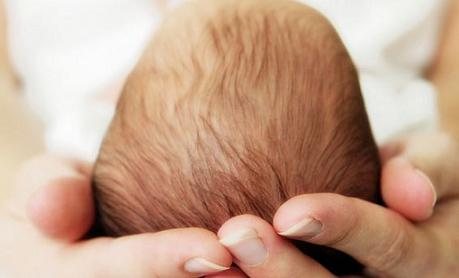 Выпадение волос у новорожденного