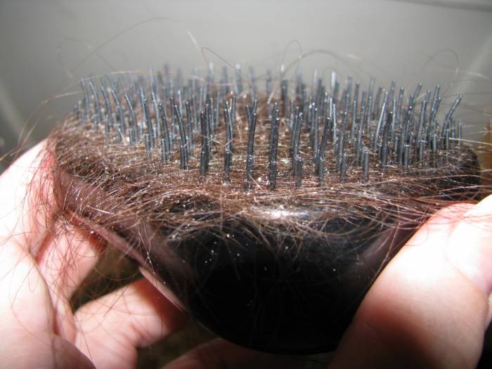 Выпадение волос у женщин: причины – щитовидка - ForeverHealth.ru