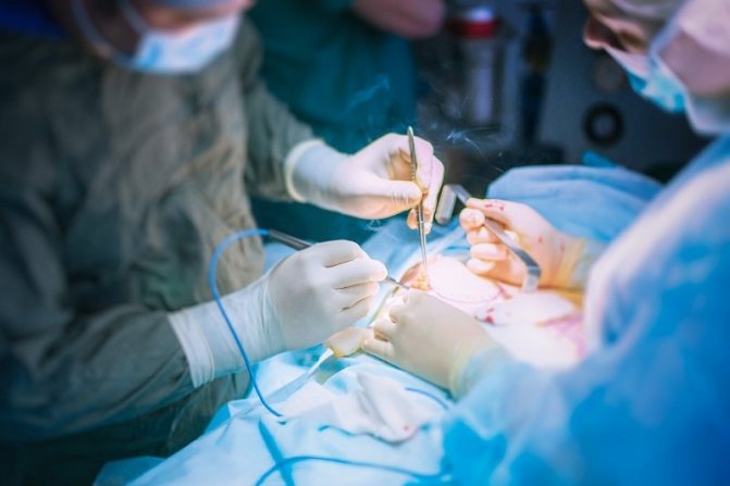 Выполнение увеличения члена в ширину с помощью хирургических методик – один из самых рискованных, но действенных способов.